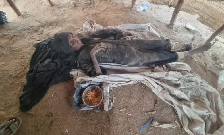 مأساة "عبس".. الجوع والمرض يختطفان "مُسنة نازحة" في حجة بعد شهر من رحيل زوجها